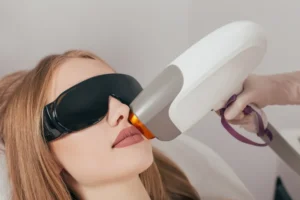 إزالة الشعر بالليزر